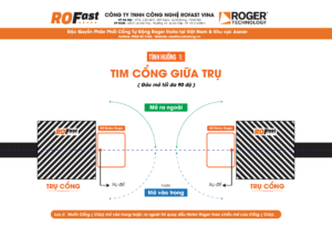 Đặt đế âm khi tim cổng giữa trụ